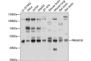 Western blot analysis of extracts of various cell lines, using PRKB antibody (ABIN6130039, ABIN6146193, ABIN6146194 and ABIN6214262) at 1:1000 dilution. (PRKAR1B 抗体  (AA 190-290))