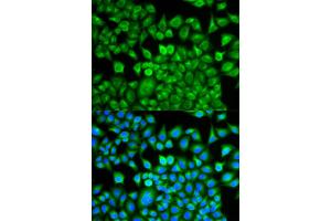 Immunofluorescence analysis of MCF-7 cells using FABP1 antibody (ABIN5973056). (FABP1 抗体)