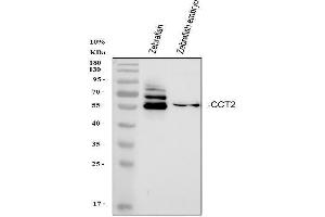Western blot analysis of Zebrafish CCT2 using anti-Zebrafish CCT2 antibody (AZQ6PBW6).