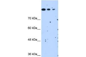 Human HepG2 cells SETD2 is strongly supported by BioGPS gene expression data to be expressed in Human HepG2 cells (SETD2 抗体  (N-Term))