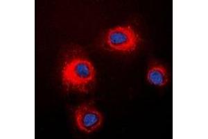 Immunofluorescent analysis of STMN1 (pS16) staining in HeLa cells. (Stathmin 1 抗体  (N-Term, pSer16))