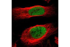 Immunofluorescent staining of U-2 OS with MCM4 polyclonal antibody  (Green) shows positivity in nucleus but excluded from the nucleoli. (MCM4 抗体)