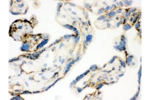IHC-F: TGM2 antibody testing of human placental tissue (Transglutaminase 2 抗体)