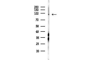 anti-Ataxin 7 (ATXN7) (Internal Region) antibody