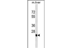 Western blot analysis in mouse liver tissue lysates (35ug/lane). (SGCD 抗体  (C-Term))