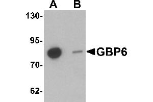 Western blot analysis of GBP6 in Hela cell lysate with GBP6 antibody at 0. (GBP6 抗体  (C-Term))