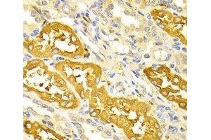 Immunohistochemistry of paraffin-embedded Human kidney using BIN1 Polyclonal Antibody at dilution of 1:100 (40x lens). (BIN1 抗体)