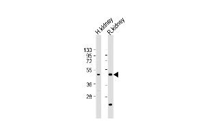 All lanes : Anti-KCNK12 Antibody (C-term) at 1:2000 dilution Lane 1: human kidney lysate Lane 2: rat kidney lysate Lysates/proteins at 20 μg per lane. (KCNK12 抗体  (C-Term))