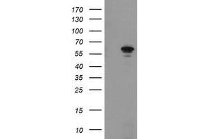 Western Blotting (WB) image for anti-Formiminotransferase Cyclodeaminase (FTCD) antibody (ABIN1496379) (FTCD 抗体)