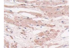 IHC-P analysis of Human Prostate Gland Tissue, with DAB staining. (Transgelin 抗体  (AA 1-201))
