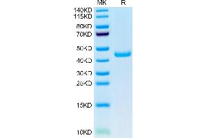 SPARC Protein (AA 18-302) (His tag)