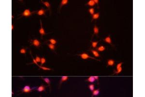 Immunofluorescence analysis of U-251MG cells using S100B Polyclonal Antibody at dilution of 1:100 (20x lens). (S100B 抗体)