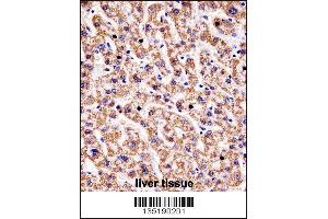 Immunohistochemistry (IHC) image for anti-Hyaluronidase-1 (HYAL1) (AA 280-309), (C-Term) antibody (ABIN5531377)