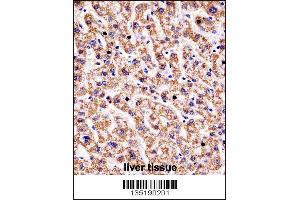 HYAL1 Antibody immunohistochemistry analysis in formalin fixed and paraffin embedded human liver tissue followed by peroxidase conjugation of the secondary antibody and DAB staining. (HYAL1 抗体  (C-Term))