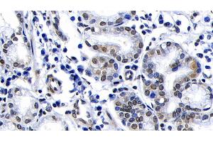 Immunohistochemistry (IHC) image for anti-Ataxia Telangiectasia Mutated (ATM) (AA 2484-2748) antibody (ABIN7433537)