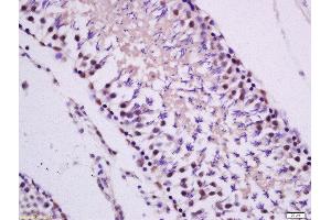 Immunohistochemistry (Paraffin-embedded Sections) (IHC (p)) image for anti-Protein Kinase C, epsilon (PRKCE) (AA 631-737) antibody (ABIN679538)