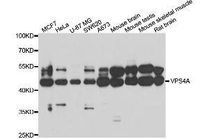 Western blot analysis of extracts of various cell lines, using VPS4A antibody (ABIN5974267) at 1/1000 dilution. (VPS4A 抗体)