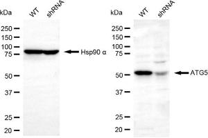 Western blotting analysis using ATG5 antibody (ABIN7797673).