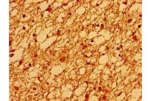 Immunohistochemistry of paraffin-embedded human brain tissue using ABIN7171099 at dilution of 1:100 (SV2A 抗体  (AA 36-149))