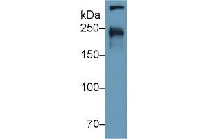 Detection of CUBN in Human Urine using Polyclonal Antibody to Cubilin (CUBN) (CUBN 抗体  (AA 3157-3274))