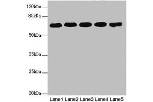 Western blot All lanes: KPNA6 antibody at 4. (KPNA6 抗体  (AA 277-536))