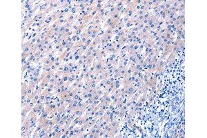 Immunohistochemistry (IHC) image for anti-Epidermal Growth Factor (EGF) antibody (ABIN3016522) (EGF 抗体)