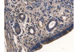 IHC-P analysis of Mouse Uterus Tissue, with DAB staining. (TMEM27 抗体  (Leu222))