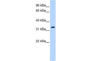 WB Suggested Anti-NCF4 Antibody Titration:  0. (NCF4 抗体  (N-Term))