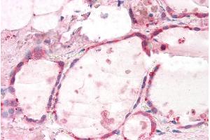 ABIN5539638 (5µg/ml) staining of paraffin embedded Human Thyroid.