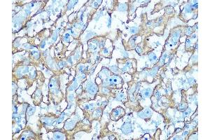 Immunohistochemistry of paraffin-embedded Rat placenta using GLUT1/SLC2 antibody (ABIN6129475, ABIN6147954, ABIN6147956 and ABIN6222743) at dilution of 1:100 (40x lens). (GLUT1 抗体  (AA 210-310))