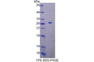 SDS-PAGE analysis of Human MTF1 Protein. (MTF1 蛋白)