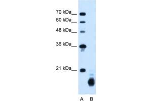 Western Blotting (WB) image for anti-Cyclophilin B (PPIB) antibody (ABIN2462813) (PPIB 抗体)