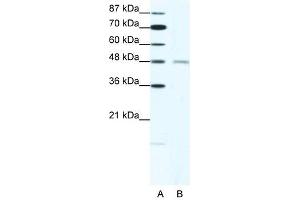 CHRND antibody (20R-1325) used at 1. (CHRND 抗体  (N-Term))