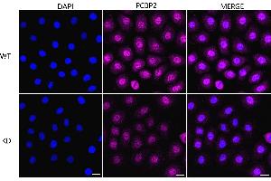 anti-Poly(rC) Binding Protein 2 (PCBP2) antibody
