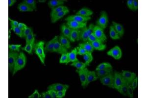 Immunofluorescence staining of HepG2 cells with ABIN7163104 at 1:133, counter-stained with DAPI. (PHEX 抗体  (AA 524-673))