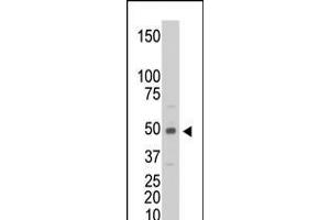 Antibody is used in Western blot to detect CKM in C6 cell lysate. (CKM 抗体  (C-Term))