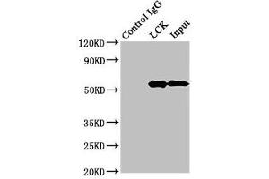 Immunoprecipitating LCK in Jurkat whole cell lysate Lane 1: Rabbit control IgG (1 μg) instead of ABIN7174038 in Jurkat whole cell lysate.