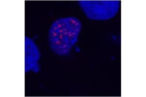 Fig. (DDDDK Tag 抗体)