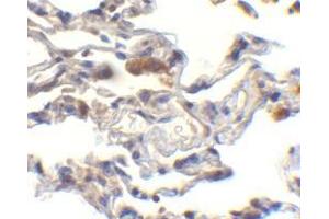 Immunohistochemistry of cIAP in human lung cells with cIAP antibody at 10 μg/ml. (BIRC2 抗体  (C-Term))