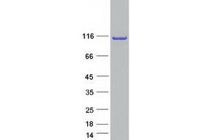 Validation with Western Blot