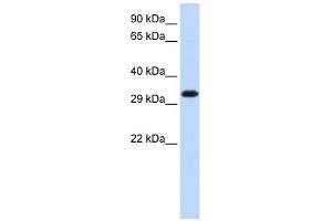 SIP1 antibody used at 1 ug/ml to detect target protein. (SIP1 抗体  (Middle Region))