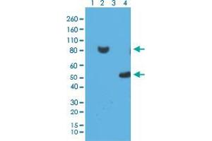 Western blot analysis of 293T cell Lane 1: untransfected with His-Tag fusion protein X, Lane 2: transfected with His-Tag fusion protein X, Lane 3: E. (His Tag 抗体  (N-Term))