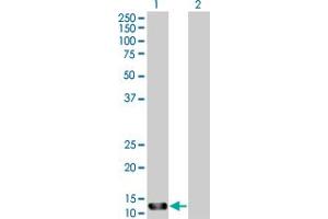 Western Blot analysis of STK10 expression in transfected 293T cell line by STK10 MaxPab polyclonal antibody. (STK10-A 抗体  (AA 12-144))