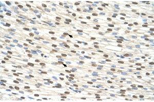 Human Heart; ZNF274 antibody - N-terminal region in Human Heart cells using Immunohistochemistry (ZNF274 抗体  (N-Term))