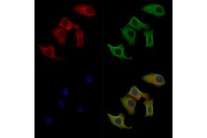 Phospho-RIPK3 (Ser199) Antibody staining Hela cells(heat shock treatment) by IF/ICC. (RIPK3 抗体  (pSer199))
