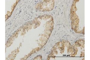 Immunoperoxidase of purified MaxPab antibody to ACPP on formalin-fixed paraffin-embedded human prostate. (ACPP 抗体  (AA 1-386))