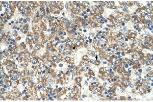 Human Liver (GOT2 抗体  (C-Term))