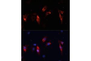 Immunofluorescence analysis of C6 cells using Cathepsin L/V/K/H antibody (ABIN6127670, ABIN6139235, ABIN6139237 and ABIN6215636) at dilution of 1:100. (Cathepsin L 抗体  (AA 114-333))