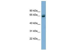 SLFN12 antibody used at 1 ug/ml to detect target protein. (SLFN12 抗体  (N-Term))