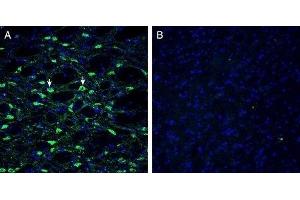 Expression of Histamine H1 Receptor in mouse substantia nigra - Immunohistochemical staining of perfusion-fixed frozen mouse brain sections with Anti-Histamine H1 Receptor/HRH1 Antibody (extracellular) (ABIN7043269, ABIN7044512 and ABIN7044513), (1:300), followed by goat anti-rabbit-AlexaFluor-488. (HRH1 抗体  (2nd Extracellular Loop))